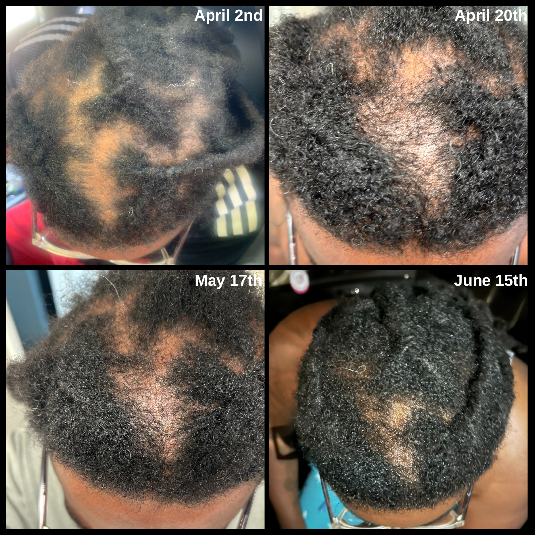 Kings Extreme Hair Growth Oil
