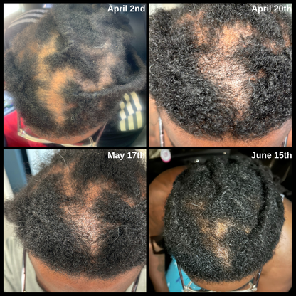 Kings Extreme Hair Growth Oil