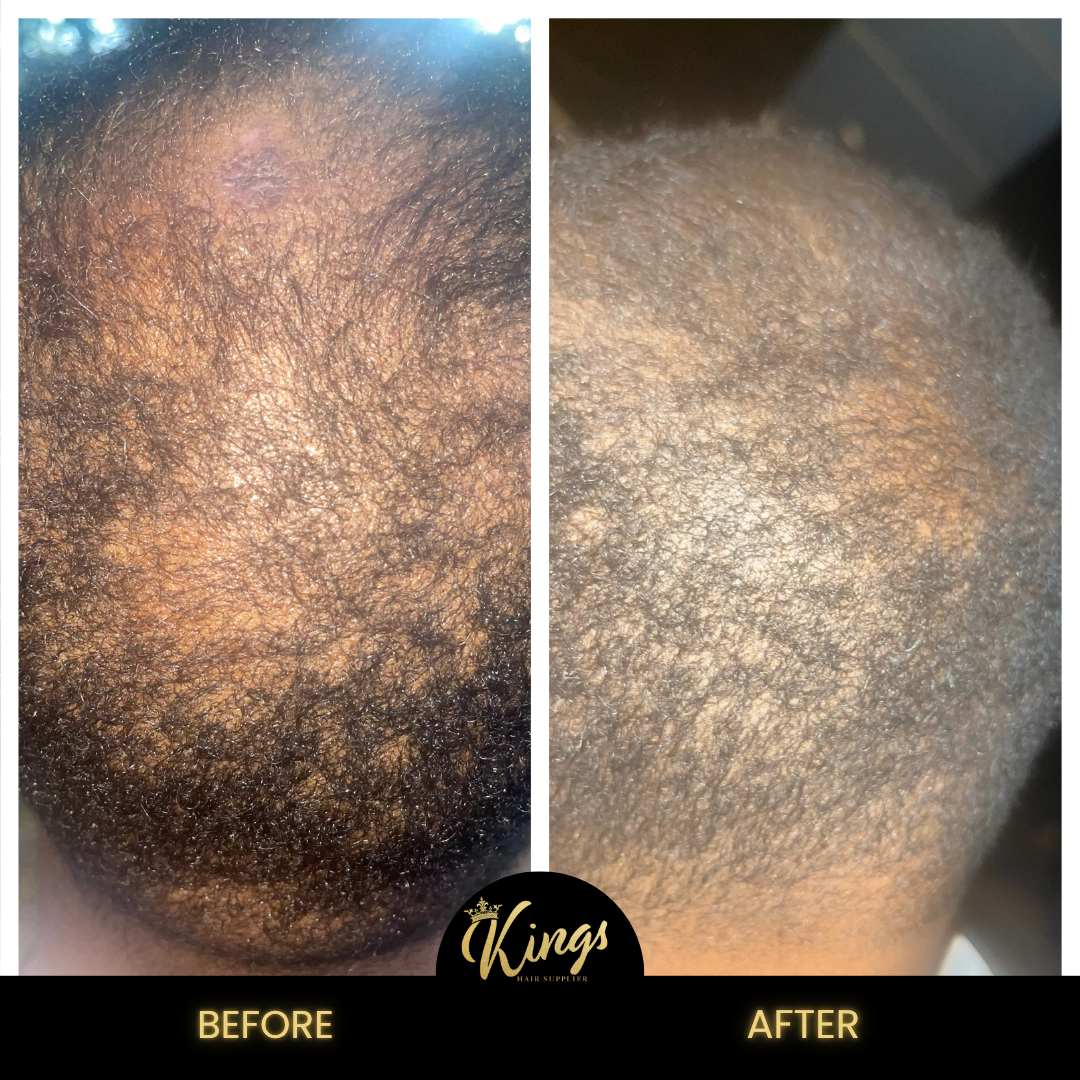 Kings Extreme Hair Growth Oil