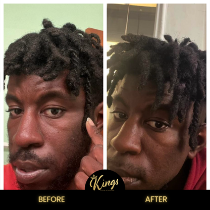Kings Extreme Hair Growth Oil