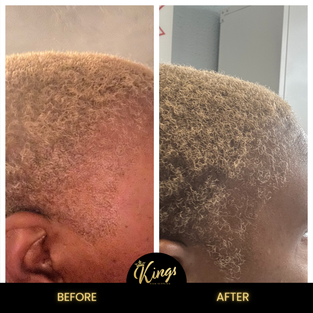 Kings Extreme Hair Growth Oil