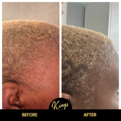 Kings Extreme Hair Growth Oil